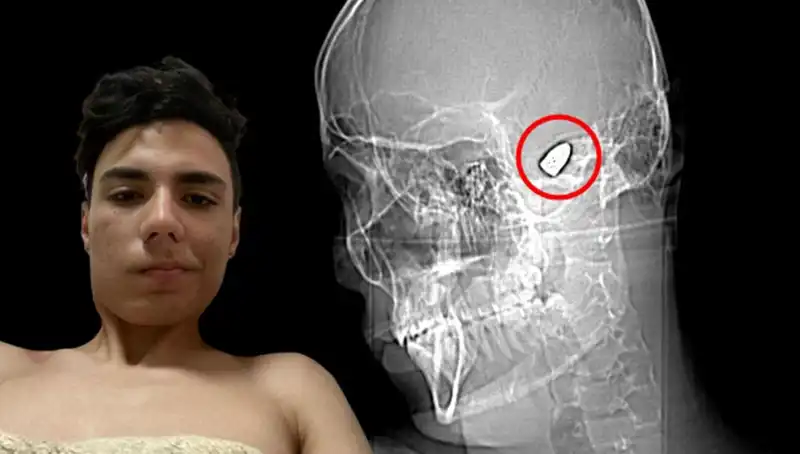 Kafasında Patlamaya Hazır Bomba Taşıyan İnsanlar: Psikolojik Efektler ve Toplum Üzerindeki Etkileri